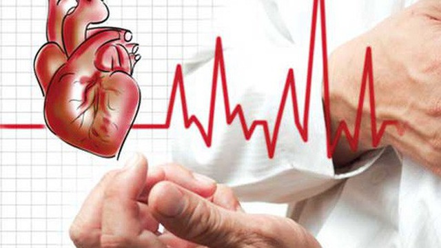 Bệnh nhồi máu cơ tim là gì?
